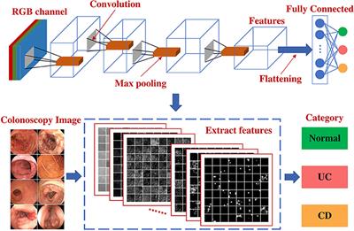 Development and Validation of a Deep Neural Network for Accurate Identification of Endoscopic Images From Patients With Ulcerative Colitis and Crohn's Disease